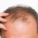 ¿Pierdes Demasiado Pelo?
