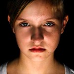 ¡Espinillas! La  peor Pesadilla de los Adolescentes! Aprende a Acabar Con Ella